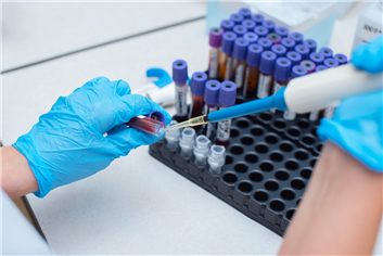 Cancer Immunotherapy Microcap Soars on Possible Major Licensing Deal